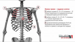 Перевал Дятлова. Травмы Дубининой.
