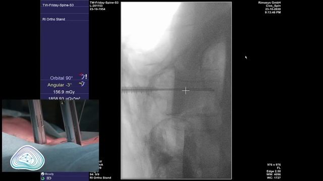 Dorsal thoracolumbal stabilization explained - percutaneous vs. open (ENGLISH SUB) смотреть онлайн