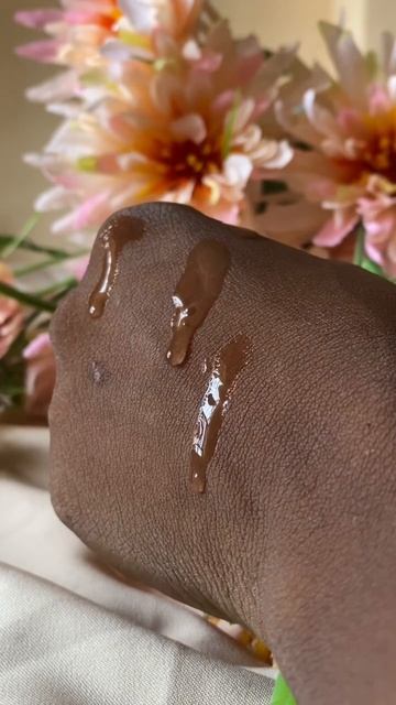 I Found a perfect serum for acne-prone skin| azelaic acid alternative 🔥 #skincare