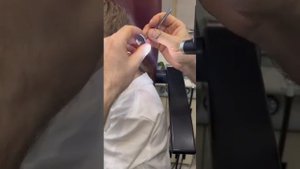 Извлекаем серную пробку из ушка ребёнка