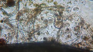 Коловратки активно питаются