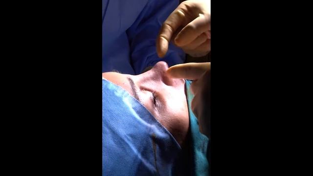 Rhinoplasty Day  | Ozge Ergun MD | Plastic Surgery | Istanbul