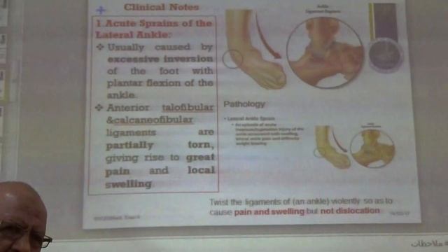 Year 3 - Module A - Ankle & Foot Joints смотреть онлайн