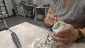 Садим каркас ацеталового (биодентопласт) протеза.