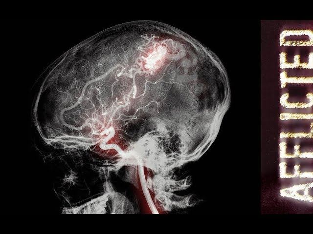 Пораженный Afflicted (2013) без спойлеров за две минуты смотреть онлайн