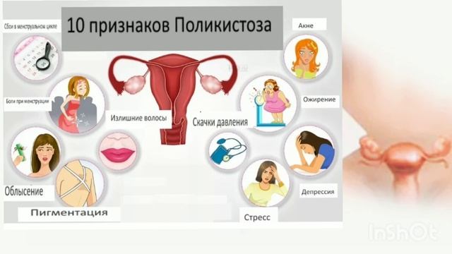 НАБУДАНИ ОВУЛЯЦИЯ ВА ПОЛИКИСТОЗ