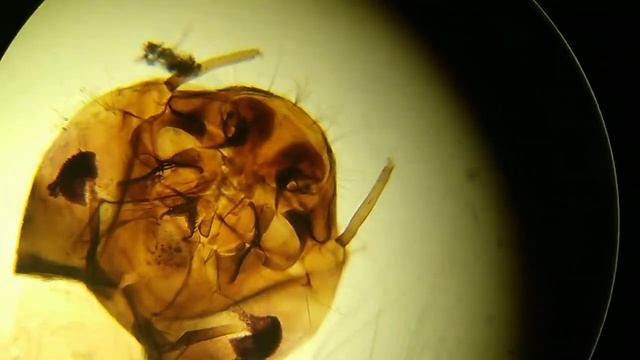 larva de Aedes albopictus com riqueza de detalhes vista no microscópio bacteriológico смотреть онлайн