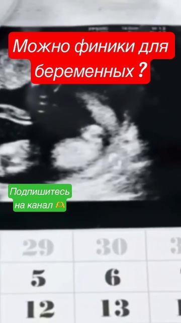Что финик делает с телом беременной 🤔 #здоровьеотприроды  #финики