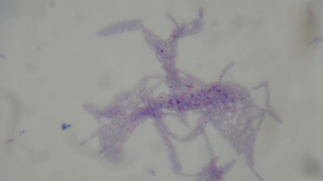 Bacillus anthracis ANTHRAX ENDOSPORES смотреть онлайн