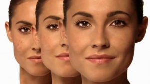 Even Better Clinical Dark Spot Corrector