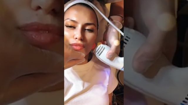 БОНЯ Виктория - Лазерная подтяжка кожи смотреть онлайн