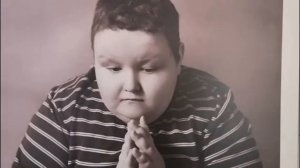 Синдром Прадера-Вилли. Регрессивный гипноз