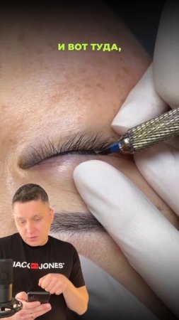 Блог про удаление ПМ и тату!  Подписывайся!
#shots