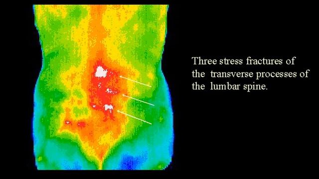 Digital Infrared Thermal Imaging video2 смотреть онлайн