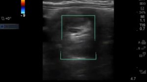 Vomiting multiple times & crying in 5 m.o. Girl