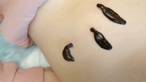 !!!!ПИЯВКИ!!!!!ПОЛЬЗА!!!!!!🪱🪱🪱