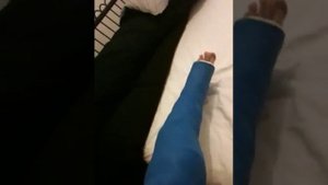 llc legcast