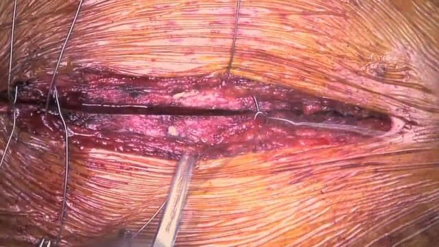 Кардиохирургия смотреть онлайн