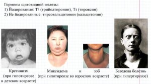 57 Эндокринная система- железы и их гормоны