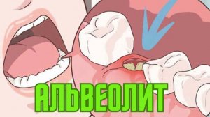 💥 Почему возникает альвеолит
