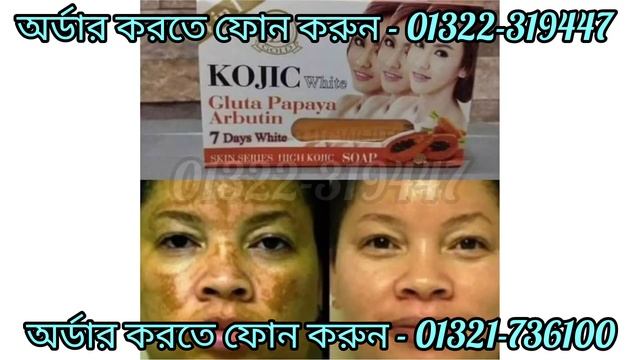 ##Kojic White Gluta Papaya Arbutin Soap,Review,Price,how to use## смотреть онлайн