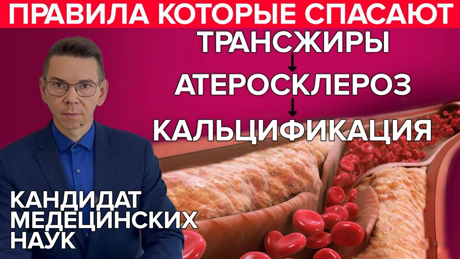 Трансжиры, Атеросклероз и кальцификация артерий. ПРАВВИЛА КОТОРЫЕ СПАСАЮТ