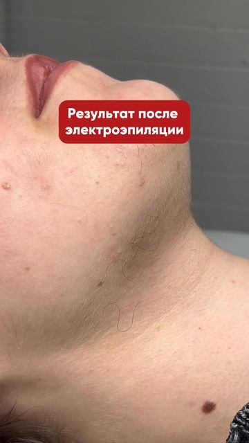 Мысли после электро