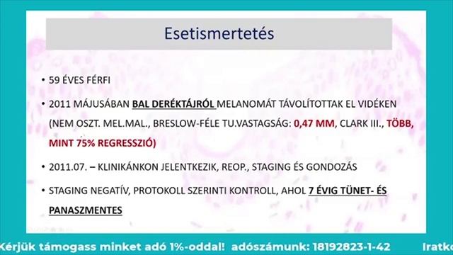 Dr. Kuroli Enikő a melanomáról - Melanoma Világnap2020 смотреть онлайн