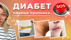 Диабет. Первые признаки