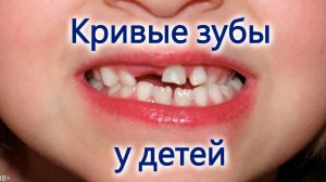 💥 Кривые зубы у детей