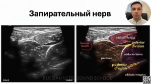 БЛОКАДА НЕРВОВ НИЖНЕЙ КОНЕЧНОСТЕЙ (РЕГИОНАРНАЯ АНЕСТЕЗИЯ) ПОД КОНТРОЛЕМ УЛЬТРАЗВУКА