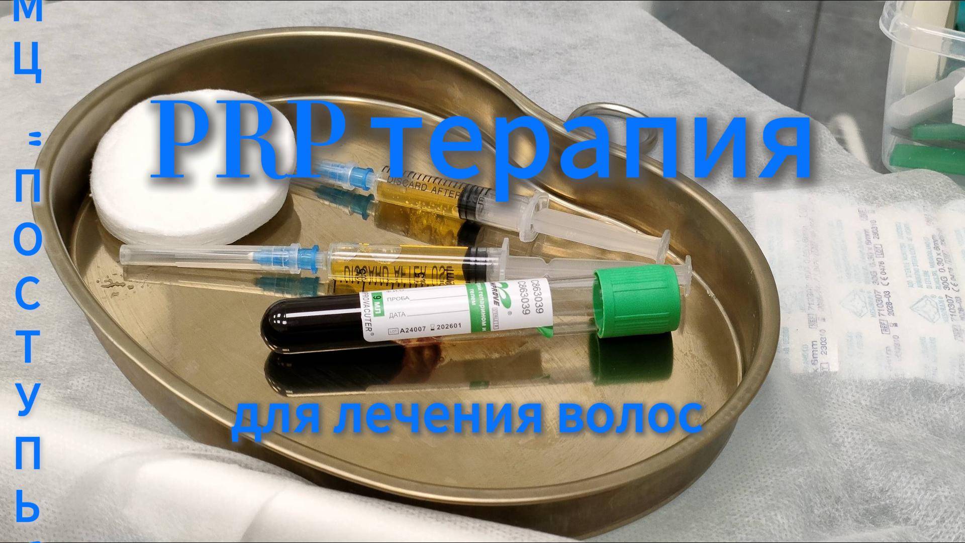 PRP терапия для лечения волос и кожи головы