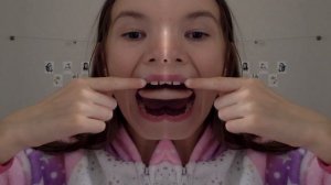 я проглотила палец