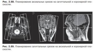 ВНЧС