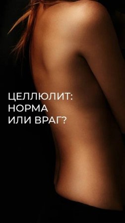 Целлюлит — это нормально.