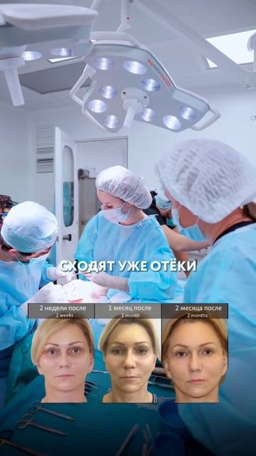 ДОЛГО ЛИ ДЛИТСЯ РЕАБИЛИТАЦИЯ ПОСЛЕ ПОДТЯЖКИ ЛИЦА?  #клиникак31 #подтяжкалица  #плас #пластикалица