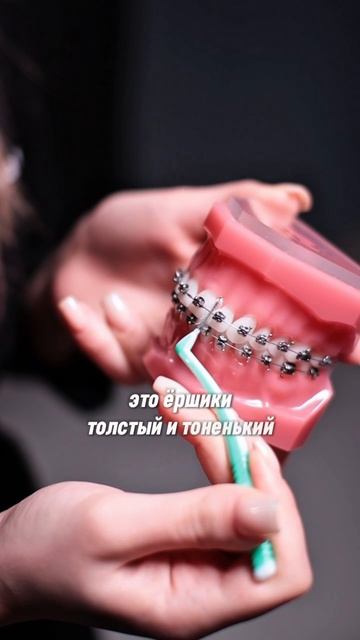 Что важно знать о гигиене при лечении на брекетах? Стоматология Smile Spa Одинцово