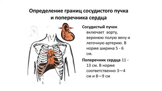 Анатомия сердца часть 2