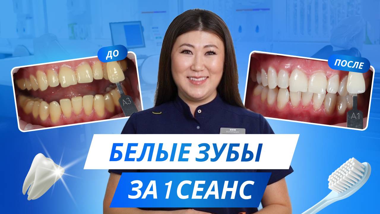 Голливудская улыбка за 1 процедуру? Отбеливание, которое шокирует!