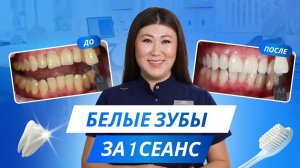 Голливудская улыбка за 1 процедуру? Отбеливание, которое шокирует!