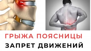 Грыжа Ограничения движений убивают позвоночник Большая проблема реабилитации Реабилитолог П Артемьев