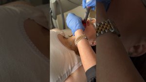 Вебинар 11.04.25. Протоколы Fotona "лицо под ключ" для пациентов 40 лет