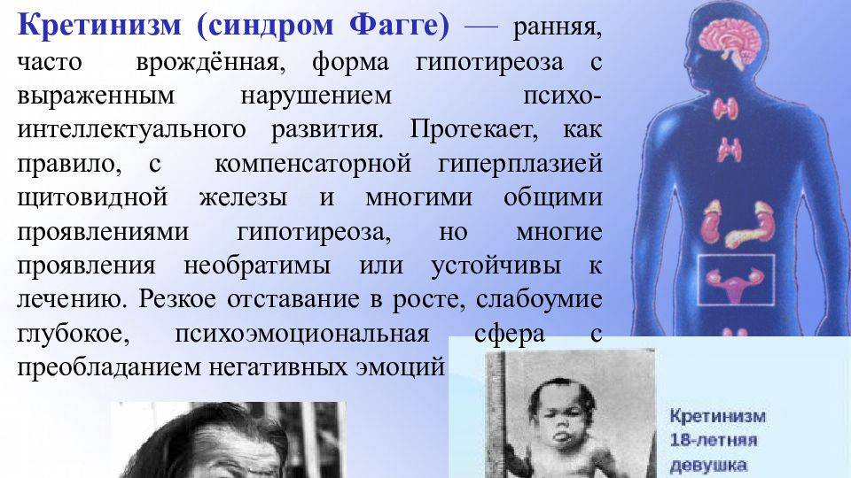 Болезнь Фагге