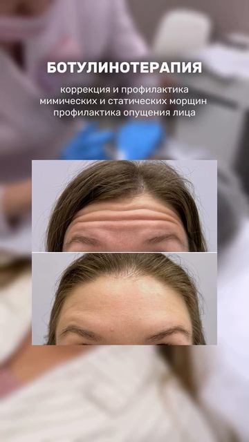 3 ПРОЦЕДУРЫ, ЧТОБЫ ПРОДЛИТЬ МОЛОДОСТЬ КОЖИ