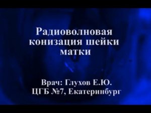 Радиоволновая конизация шейки матки