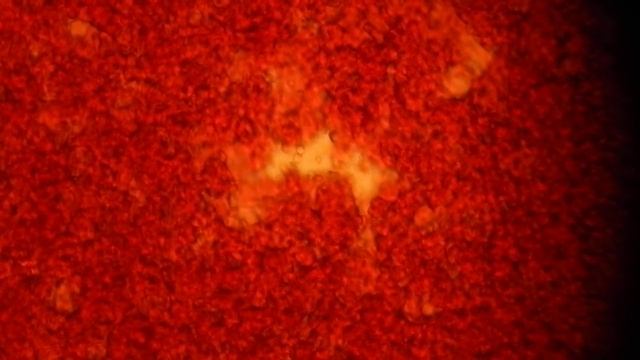 Dirofilaria pozitív natív vérkenet смотреть онлайн