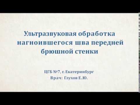 Ультразвуковая обработка нагноившегося шва переднеи брюшнои стенки