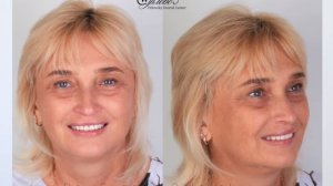 Отзыв Ломова Эллина о Центре стоматологии Орловских Orlovsky Dental Center Правобережье город Калуга