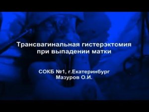 Трансвагинальная гистерэктомия при выпадении матки