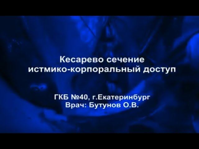 Кесарево сечение истмико корпоральныи доступ
